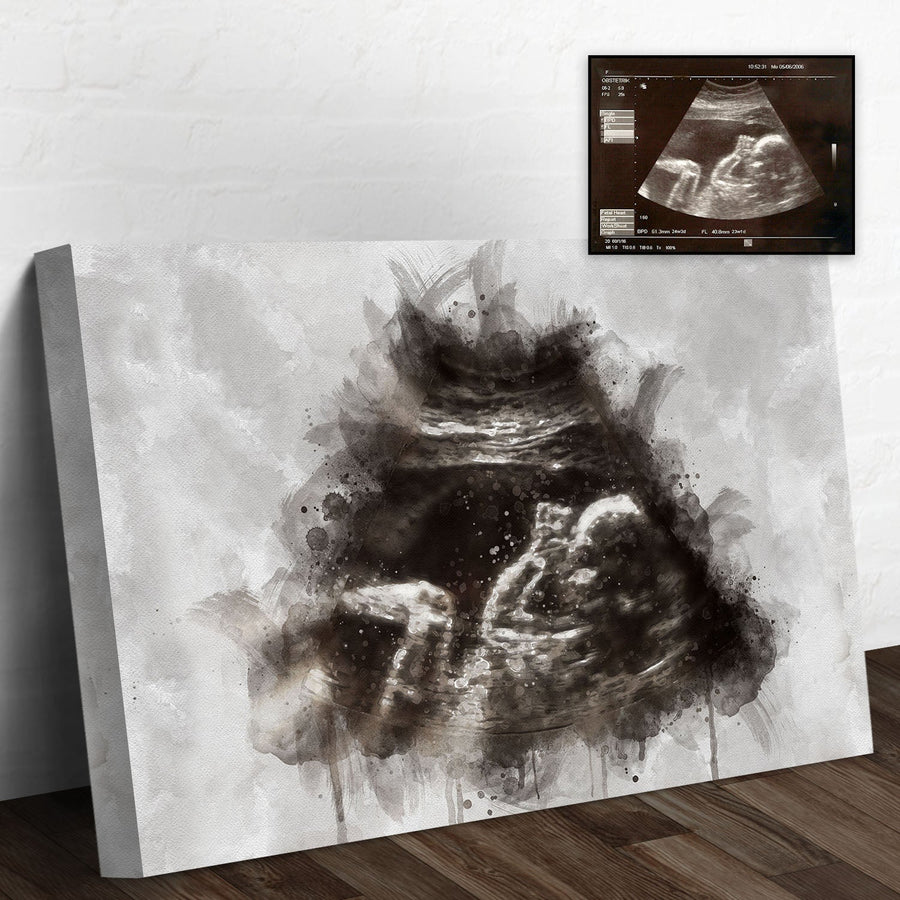 Custom Baby Ultrasound Watercolor Portrait